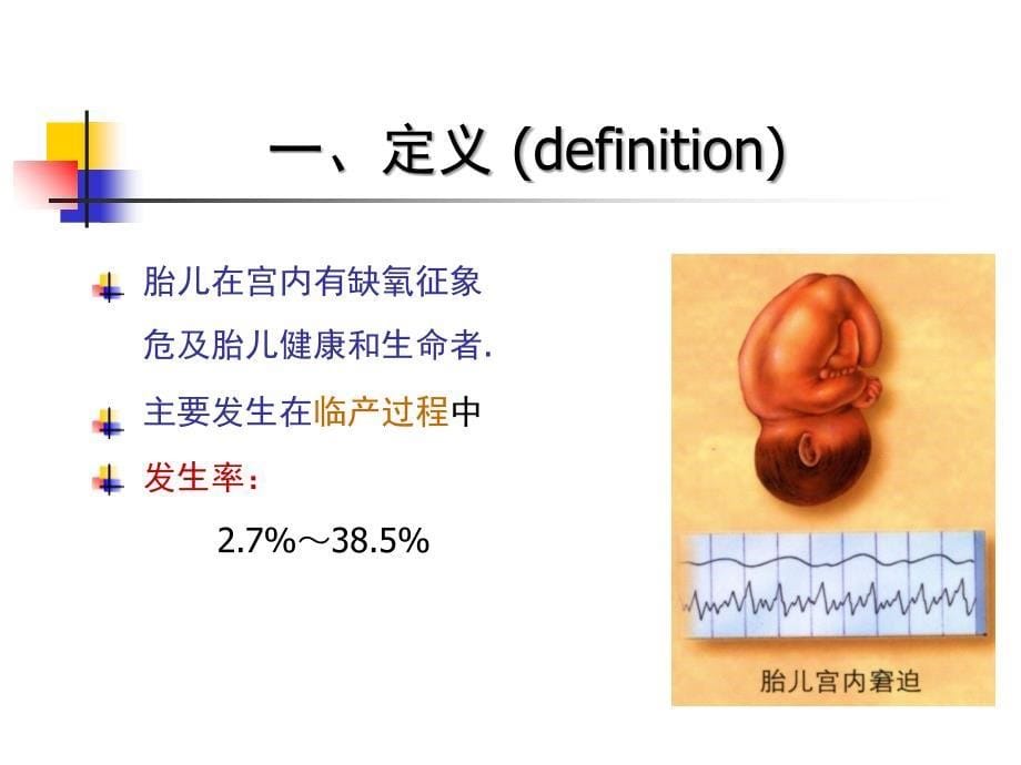 胎儿宫内窘迫PPT优秀课件_第5页