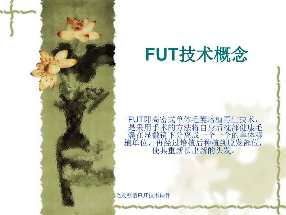 毛发移植FUT技术课件_第2页