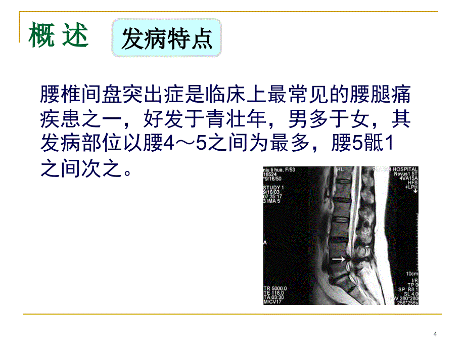 腰椎间盘突出症的针灸治疗ppt课件_第4页