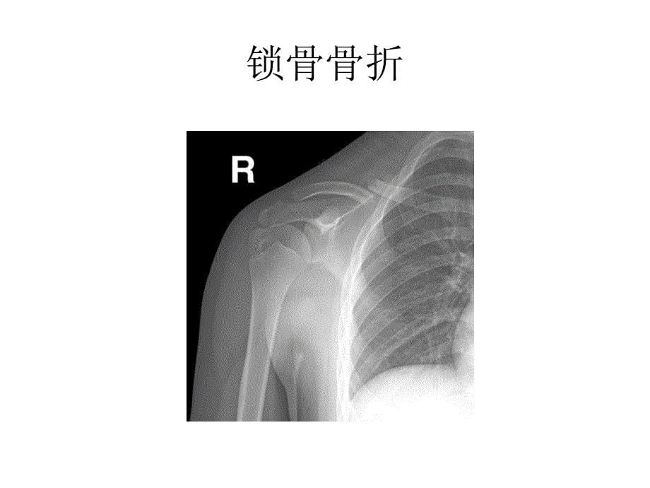 骨关节创伤图片_第5页