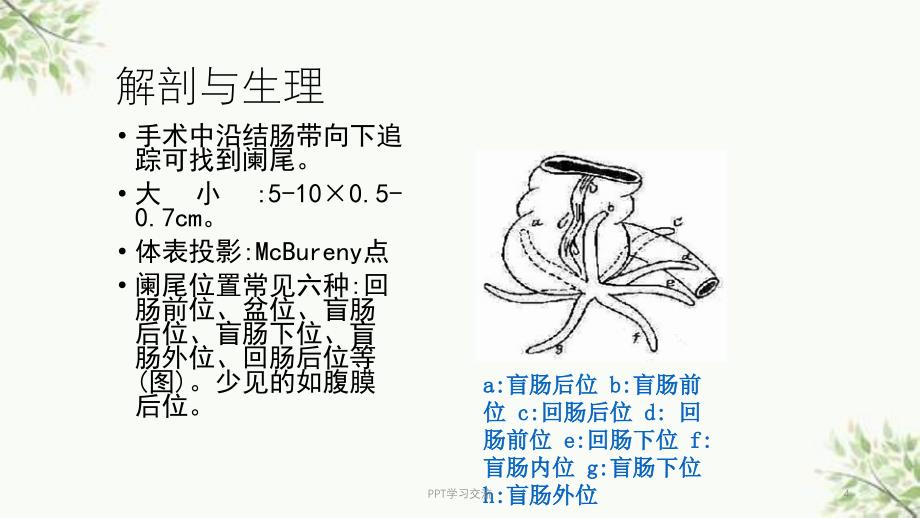 急性阑尾炎新ppt课件_第4页