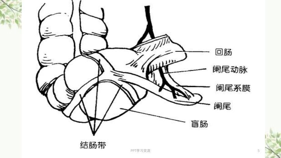 急性阑尾炎新ppt课件_第5页