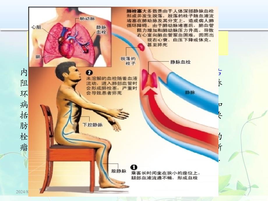 临床病例分析：一例肺栓塞患者的药学监护_第4页