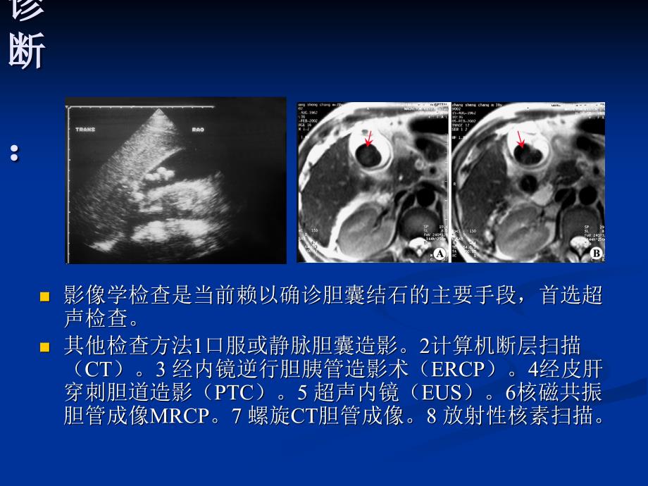 胆结石课件PPT_第3页