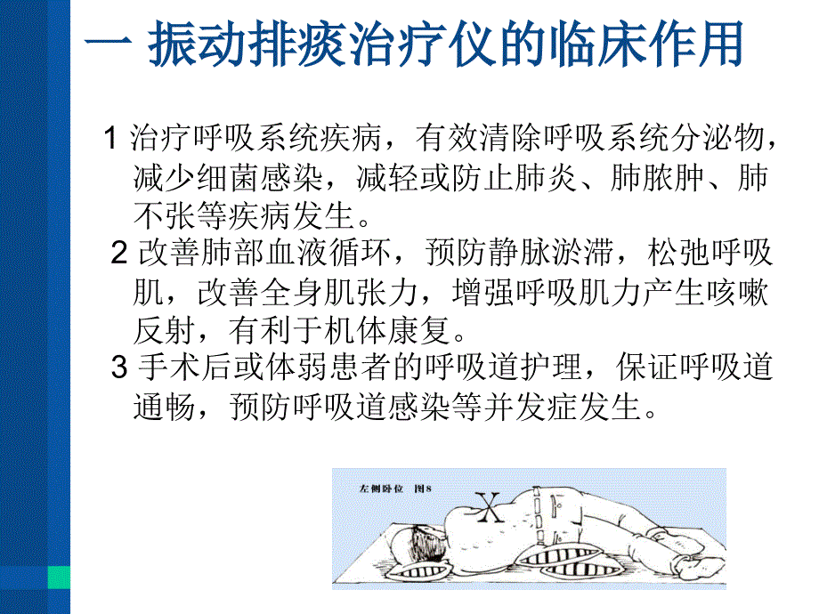 振动排痰治疗仪的使用方法.ppt_第3页