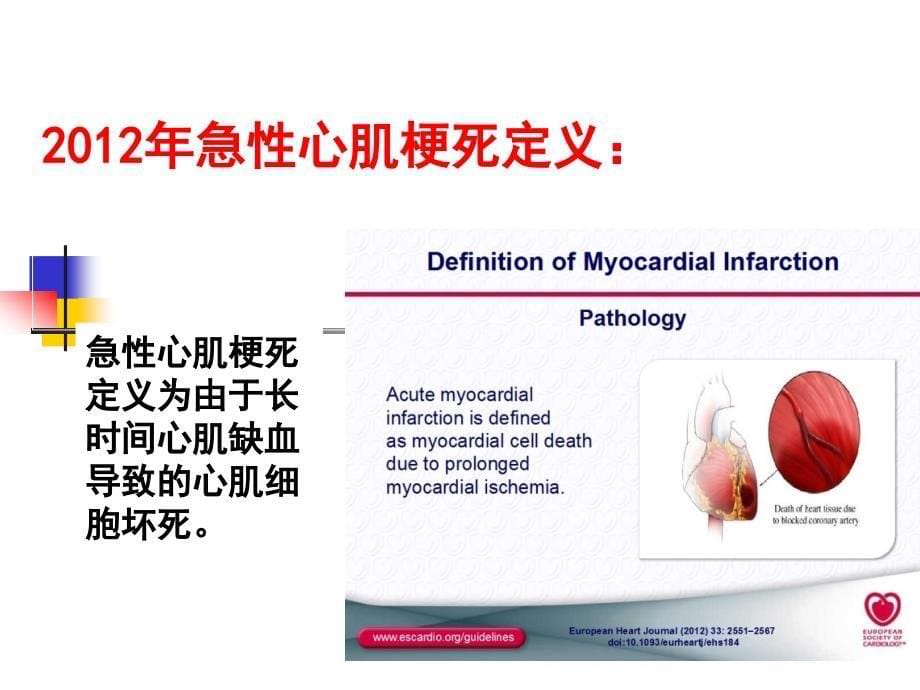 内科年会急性心肌梗死概念新进展_第5页