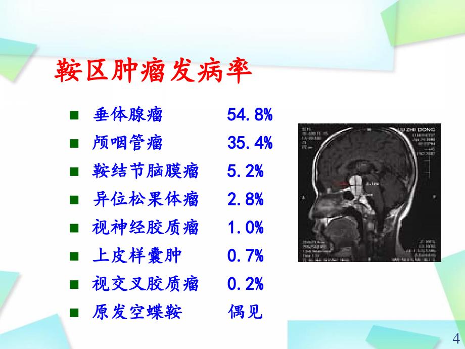 优质课件颅咽管瘤_第4页