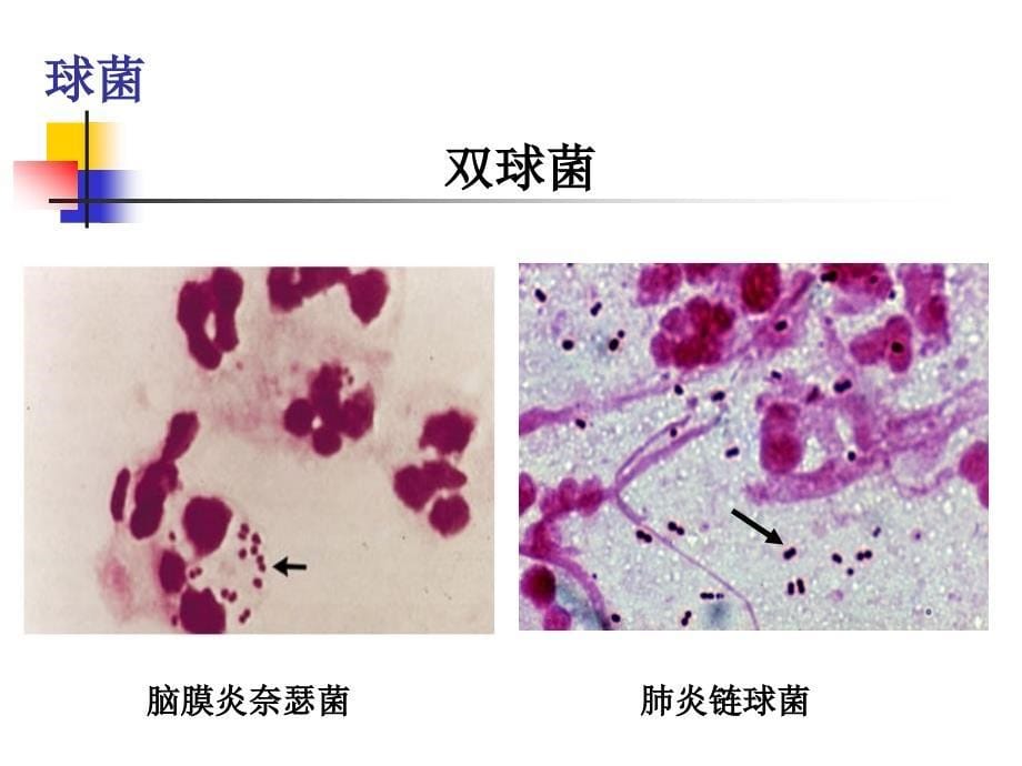 第二章--细菌概述讲述课件_第5页