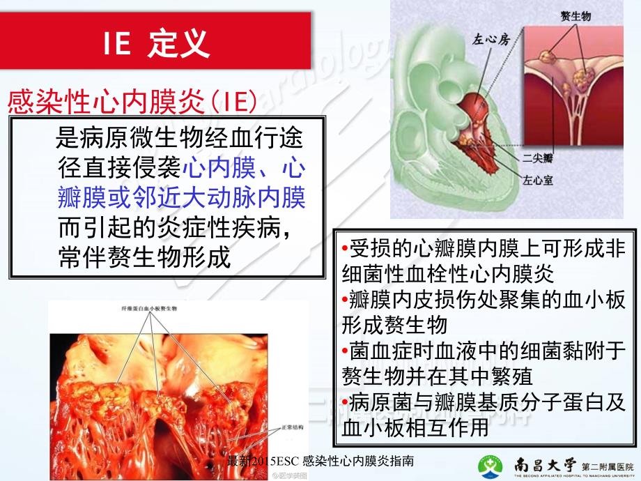 感染性心内膜炎的管理ESCIE_第2页