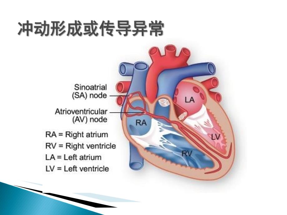 手术麻醉期心律失常课件_第2页