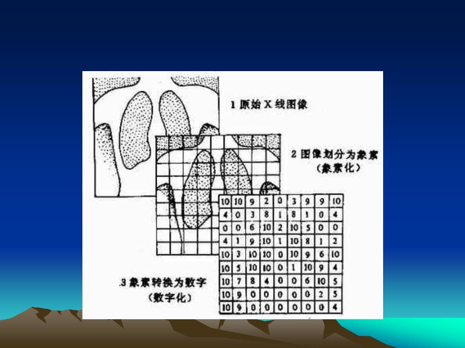 数字减影血管造影(DSA).ppt_第4页