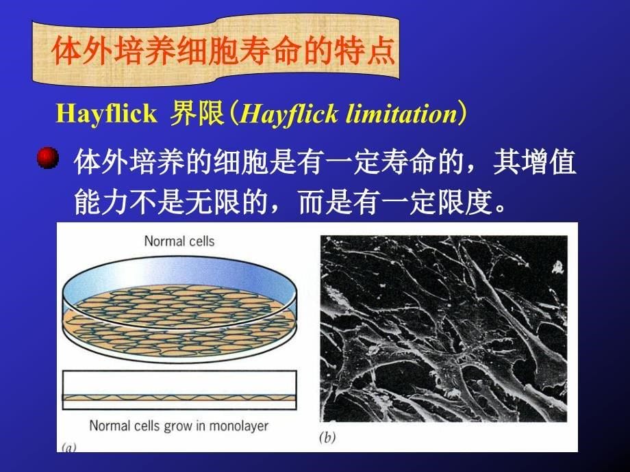 细胞生物学：第14章 细胞衰老与死亡_第5页