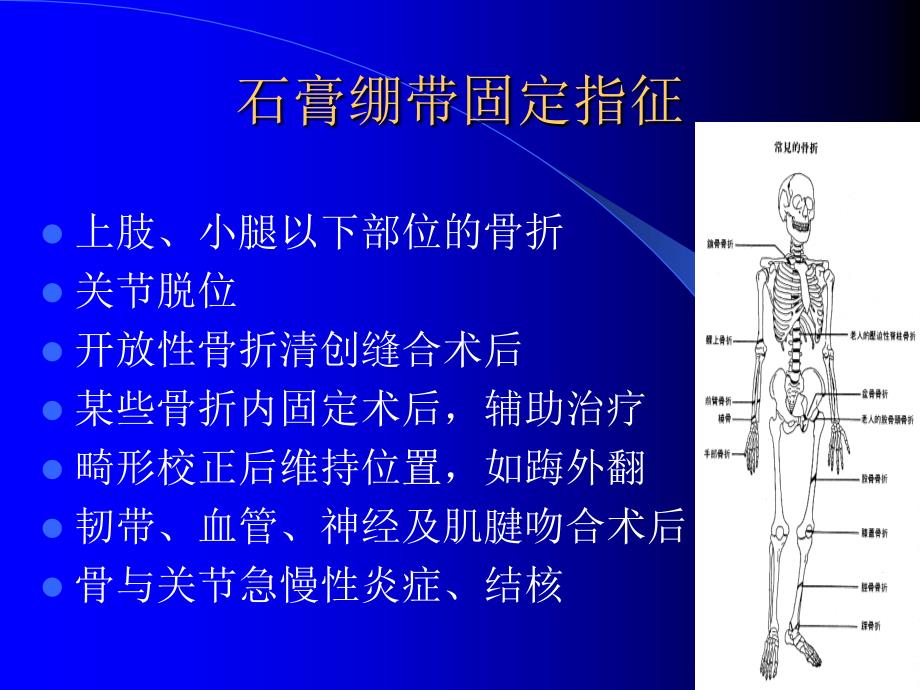 石膏夹板骨牵引固定技术课件_第4页