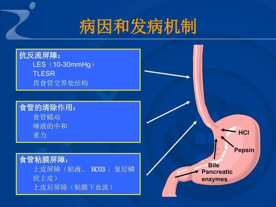 内科学教学课件：胃食管反流病_第5页