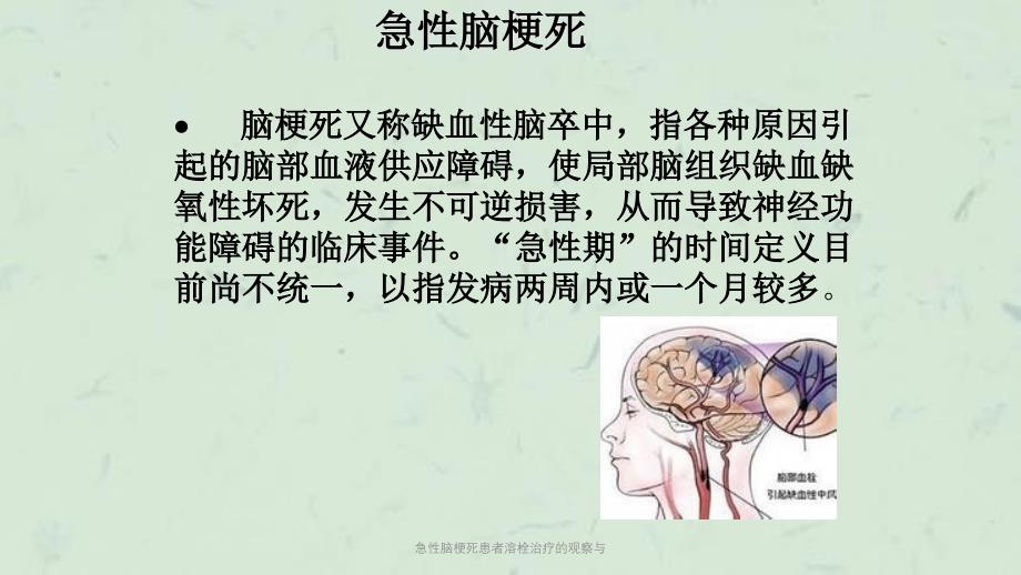 急性脑梗死患者溶栓治疗的观察与课件_第2页