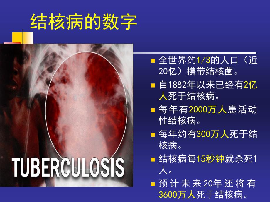 不典型肺结核的临床诊治_第3页