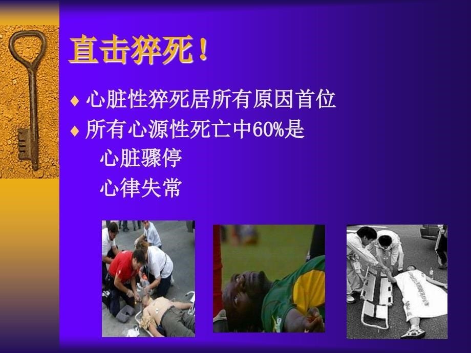 循环系统常用诊疗技术及护理.ppt_第5页