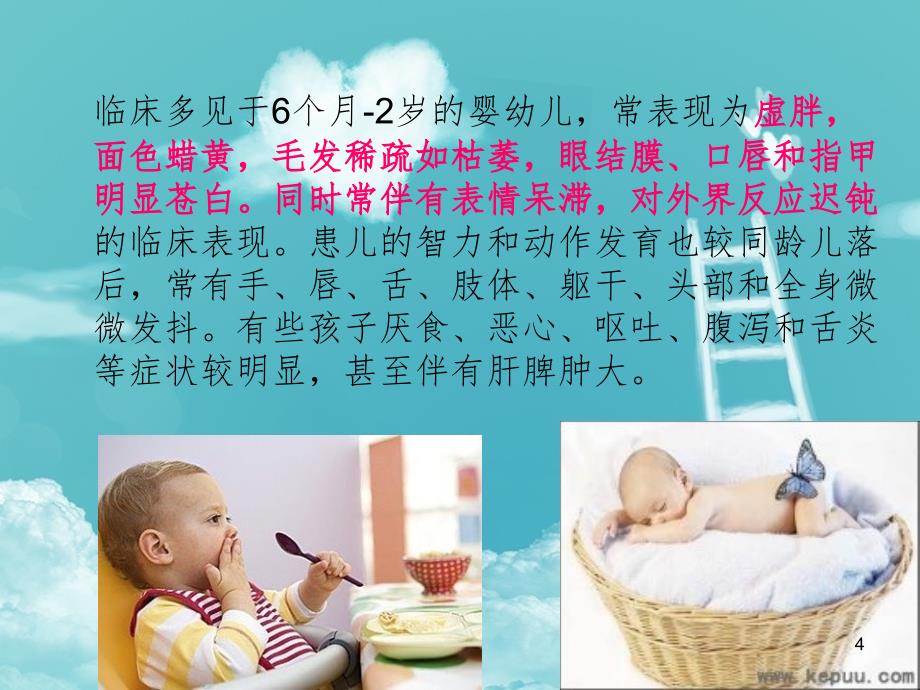 巨幼红细胞性贫血PPT精品文档_第4页