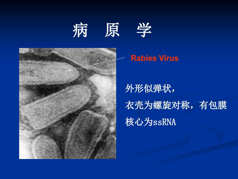 狂犬病(护本内科护理学)ppt课件.ppt_第3页