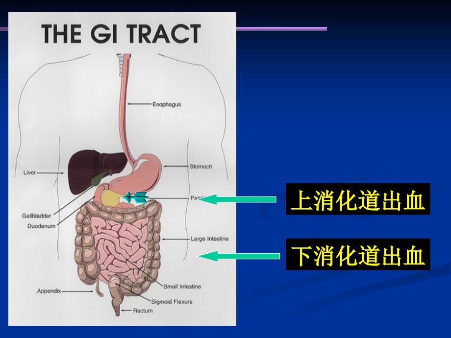 上消化道出血_第2页