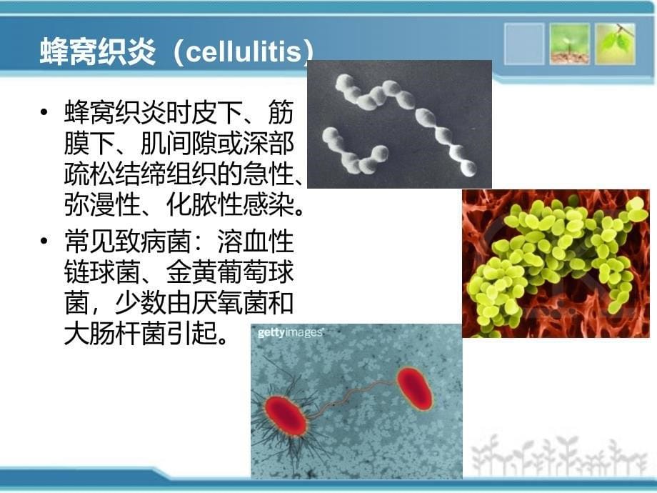 蜂窝织炎护理ppt课件_第5页