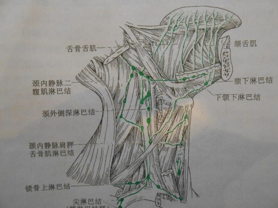 浅表淋巴结的超声诊断_第5页