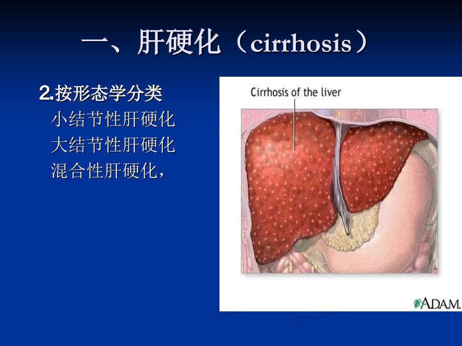 《肝脏弥漫性疾病》PPT课件_第3页