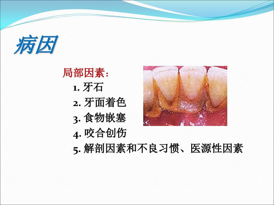 第五、六章-牙周和口腔粘膜病课件_第3页