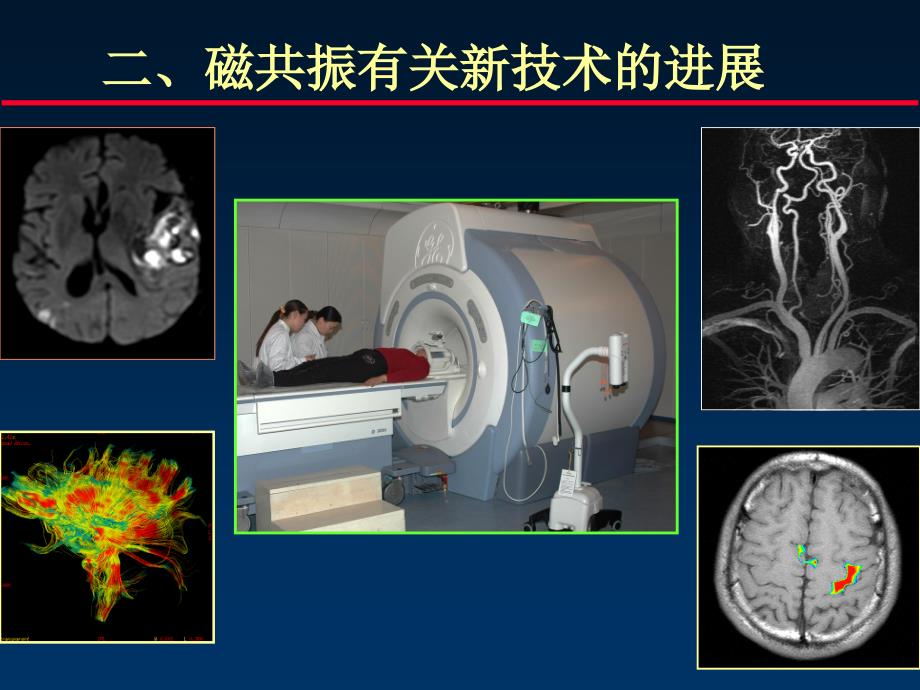 《mr进展与解剖》ppt课件_第1页