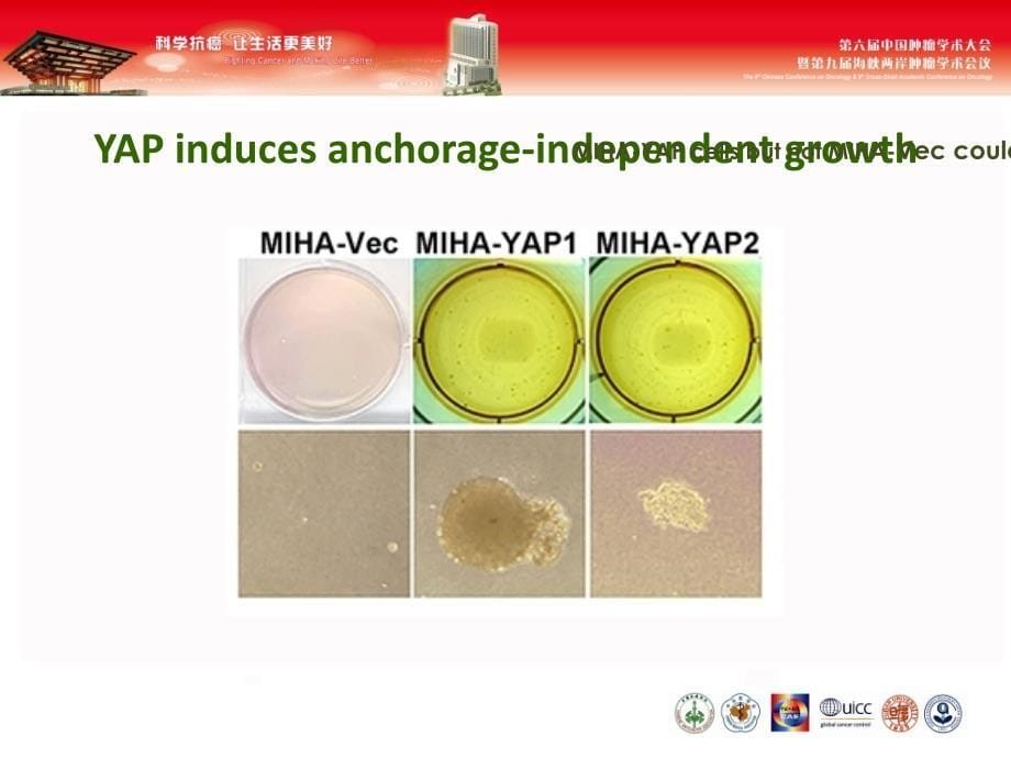 肝细胞癌中表达南京医科大学综述_第5页