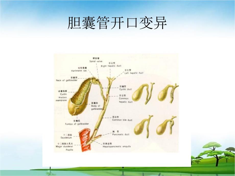 民勤县协和医院胆囊结石及其防治_第4页