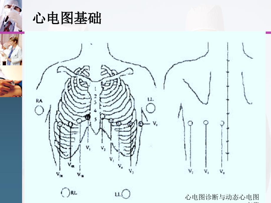 心电图诊断与动态心电图李蕊课件_第3页