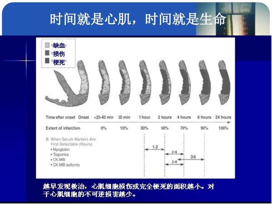 医学ppt中国专家共识溶栓_第4页