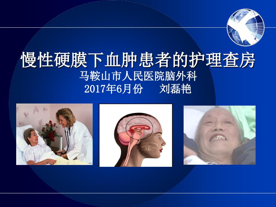 慢性硬膜下血肿护理查房ppt课件.ppt_第1页