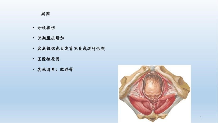 盆腔器官脱垂干货分享_第5页