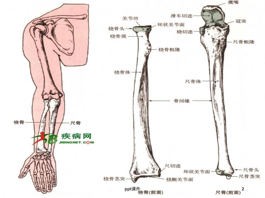 尺桡骨骨折的护理课件_第2页