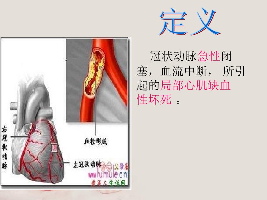 急性心肌梗死的溶栓护理查房_第3页