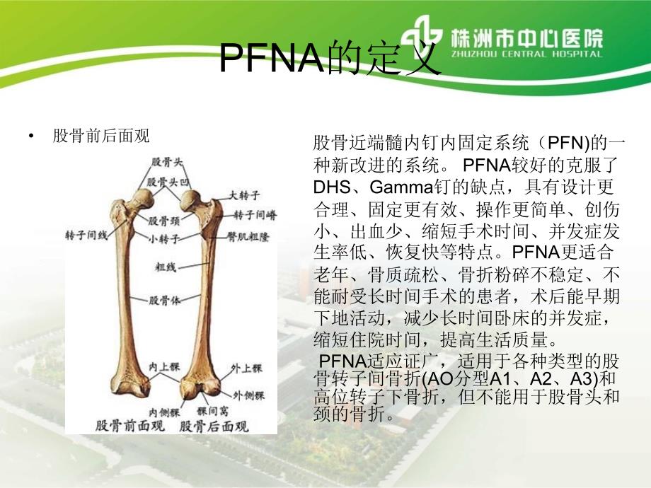 PFNA内固定术的护理查房_第2页