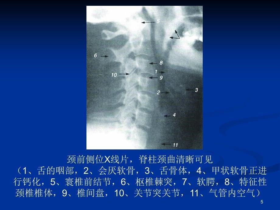 《整脊影像学诊断》PPT课件_第5页