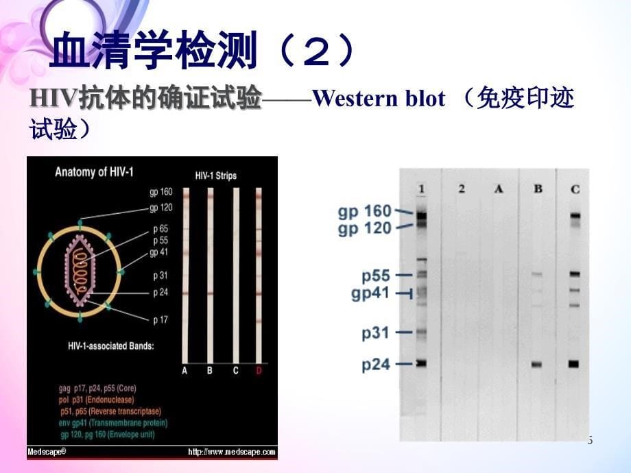 艾滋病实验室检查_第5页