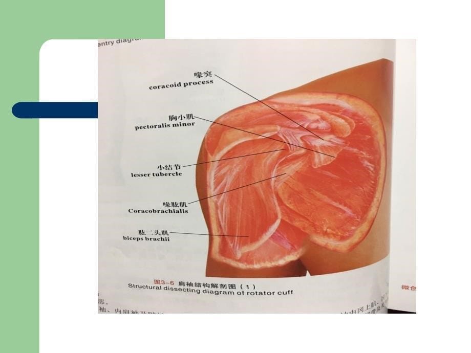 肩部肌肉分布及功能.ppt_第5页