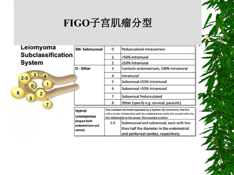 腹腔镜下子宫肌瘤剔除术_第3页