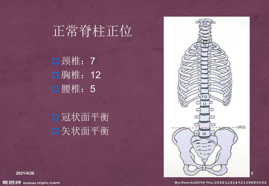 脊柱侧弯基础知识医学课件_第3页