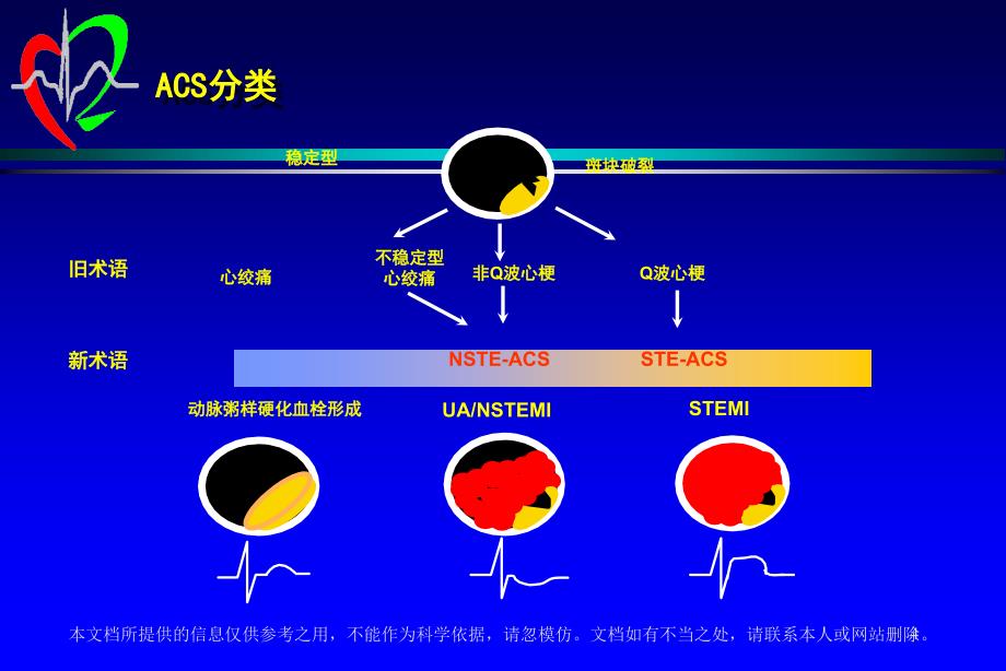 急性冠脉综合征治疗新进展_第4页