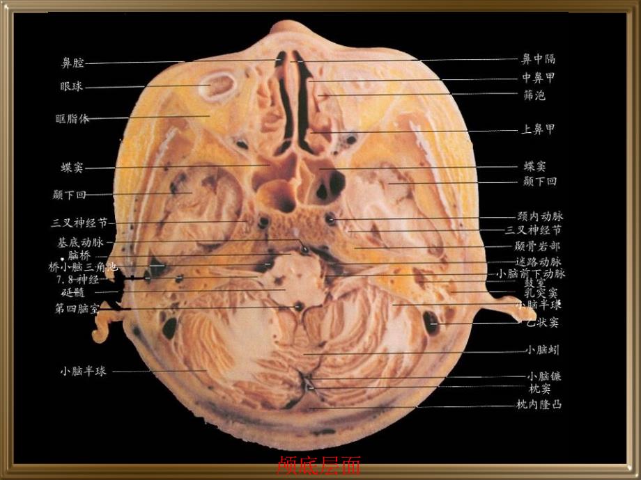 中枢神经系统断层影像_第3页