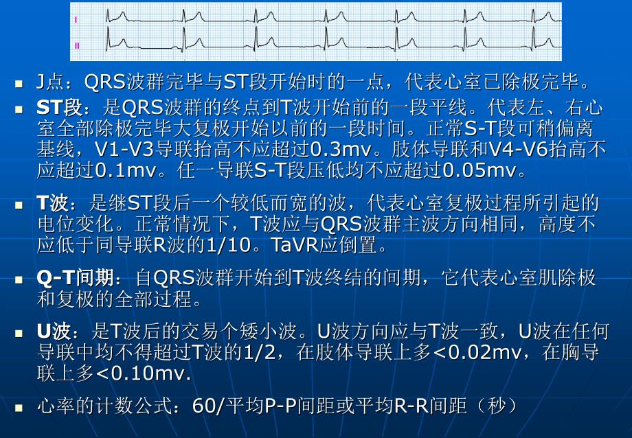 心电图基础知识_第4页