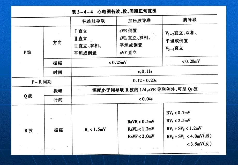 心电图基础知识_第5页