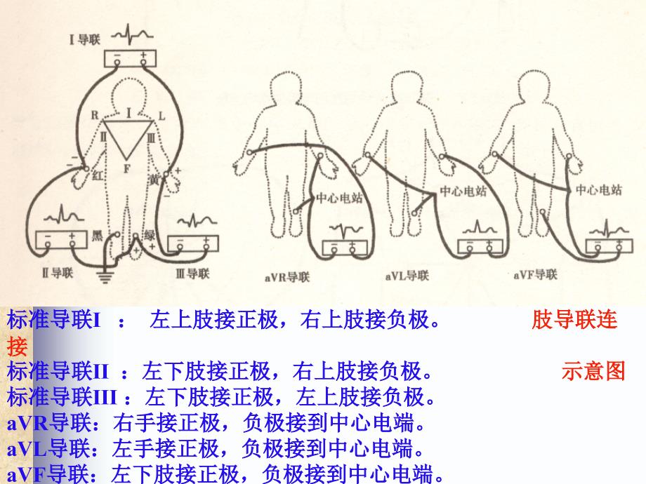 常见心电图诊断基础.ppt_第4页