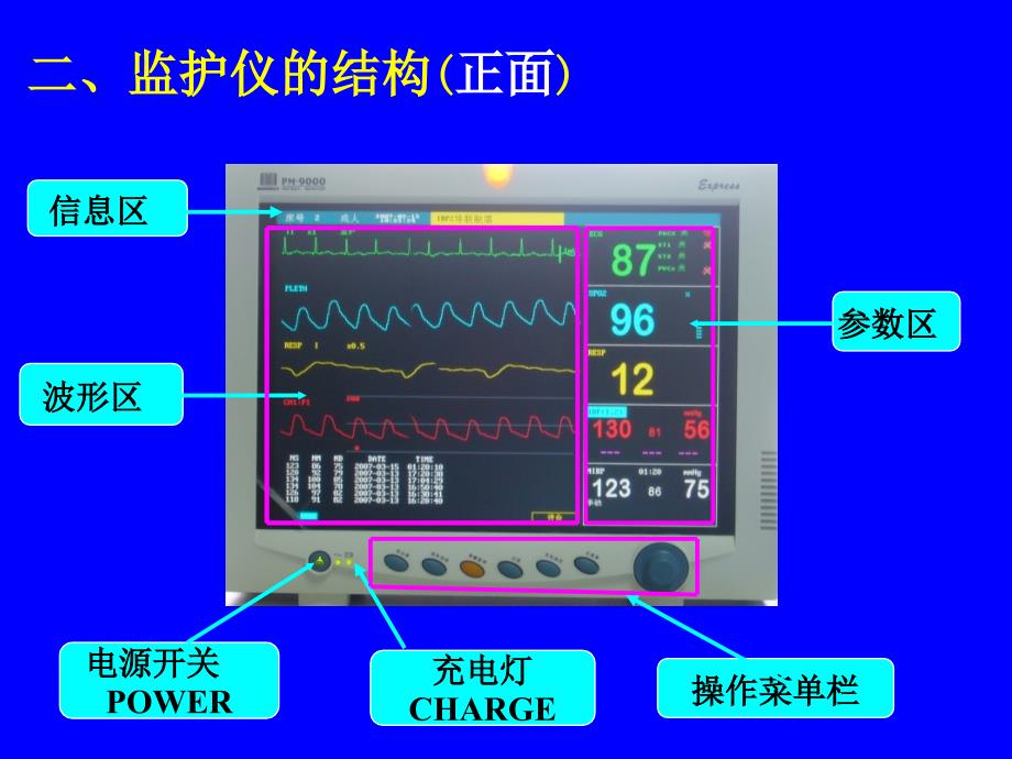 多功能监护仪的应用(主讲)PPT_第4页