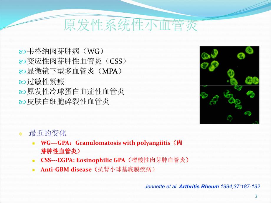 ANCA相关小血管炎的诊断和治疗ppt课件_第3页